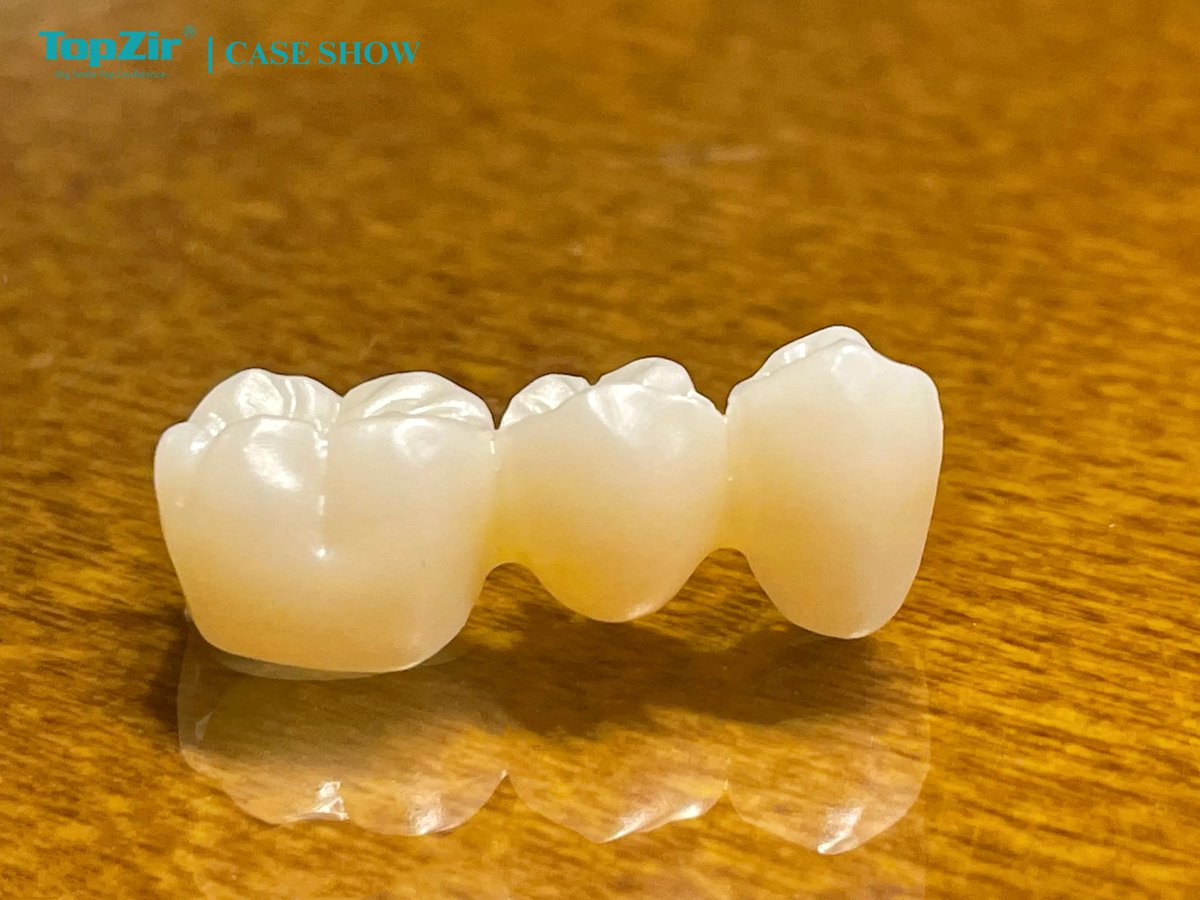 KyrieTopzir's tweet photo. 🌟 Case Show: Dental Multilayer Zirconia Block 🌟

Our latest multilayer zirconia blocks offer not only high strength and toughness but also a beautiful, natural appearance.

🔍 Features:
Excellent wear resistance
Fine layering effect
Natural color transition

#DentalBeauty https://t.co/d6K34X9Zhz