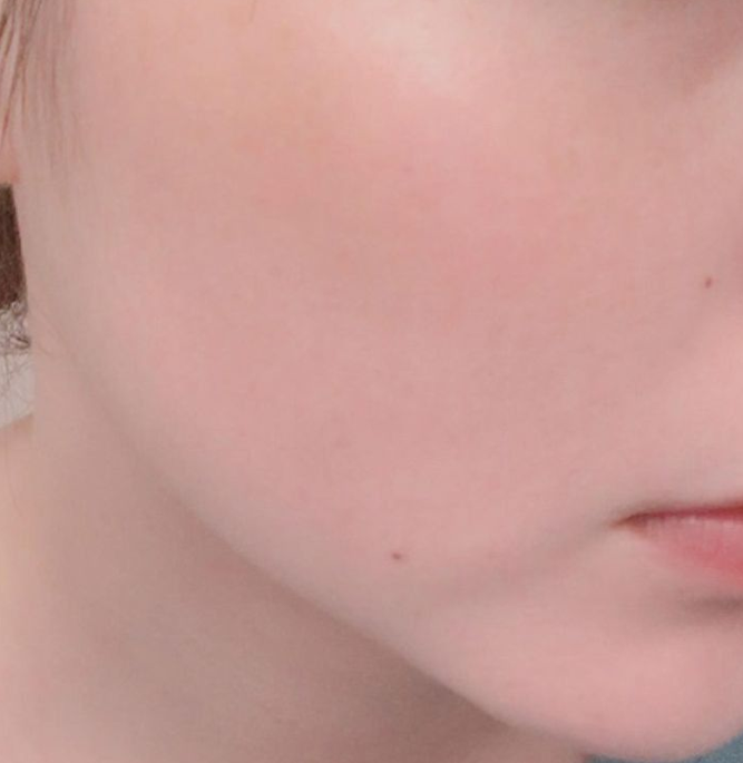 알란테놀 재생크림 2주동안 매일 써본 후기
까놓고 솔직하게 장단점 써볼게요

장점- 민감성 피부라 스치기만 해도 여드름 나는데
이거 아침 저녁으로 바르니까 바로 가라앉음

단점 – 이거 믿고 화장 안지우고 자는 버릇 생김