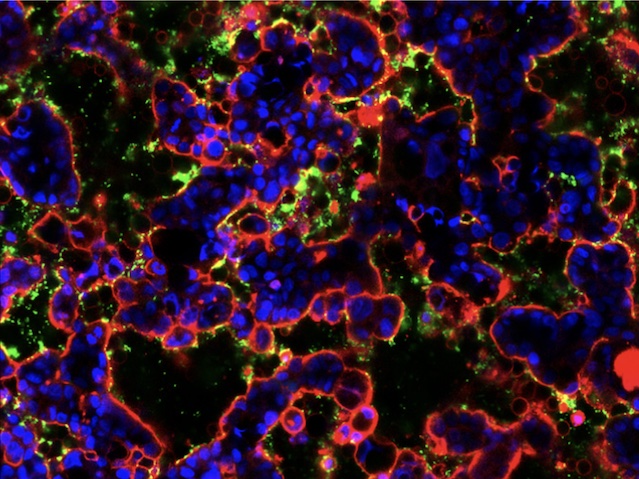 BPoD_s's tweet photo. Microbiome-on-a-chip: a 3D miniature means to study the gut's good and bad microbes &amp; their interactions

📷: Jeeyeon Lee, Nishanth Menon @CTLimLab @NUSingapore in Advanced Science @AdvPortfolio 
➡️:https://t.co/30m38Pm3P6 with @AntDLewis https://t.co/eD27VkEbys
