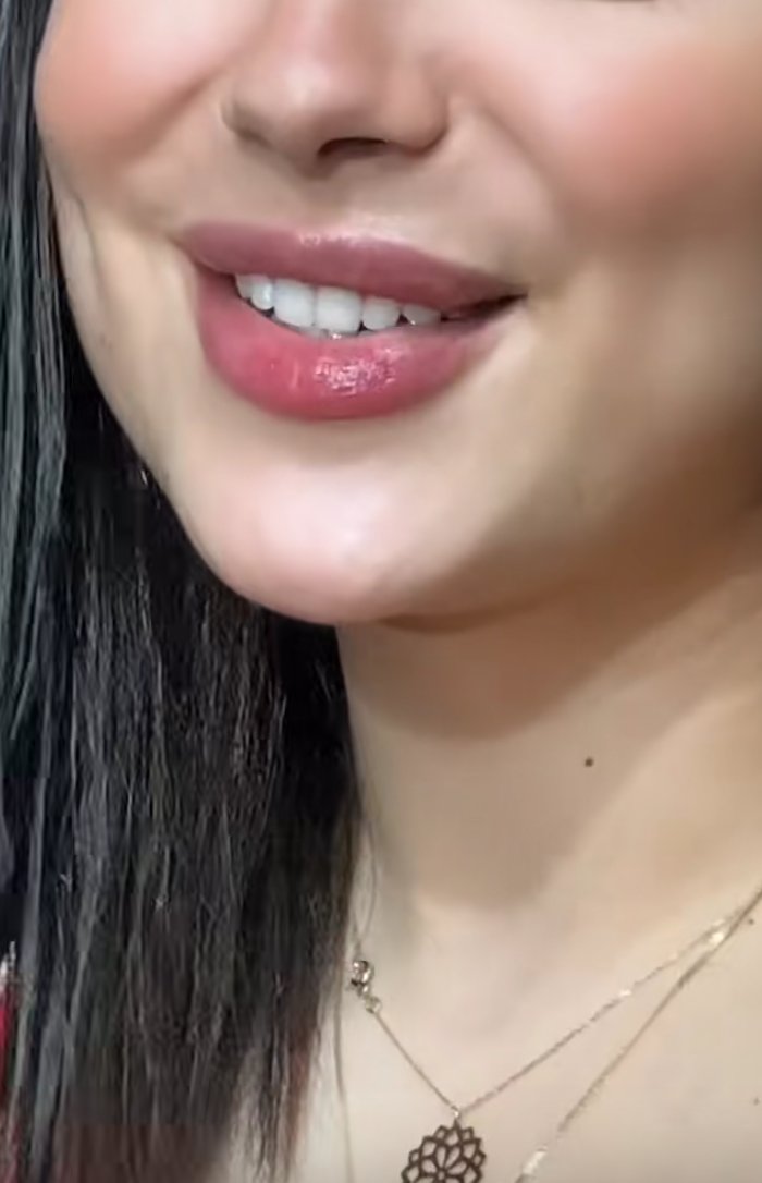 VAR"""يوم جميل