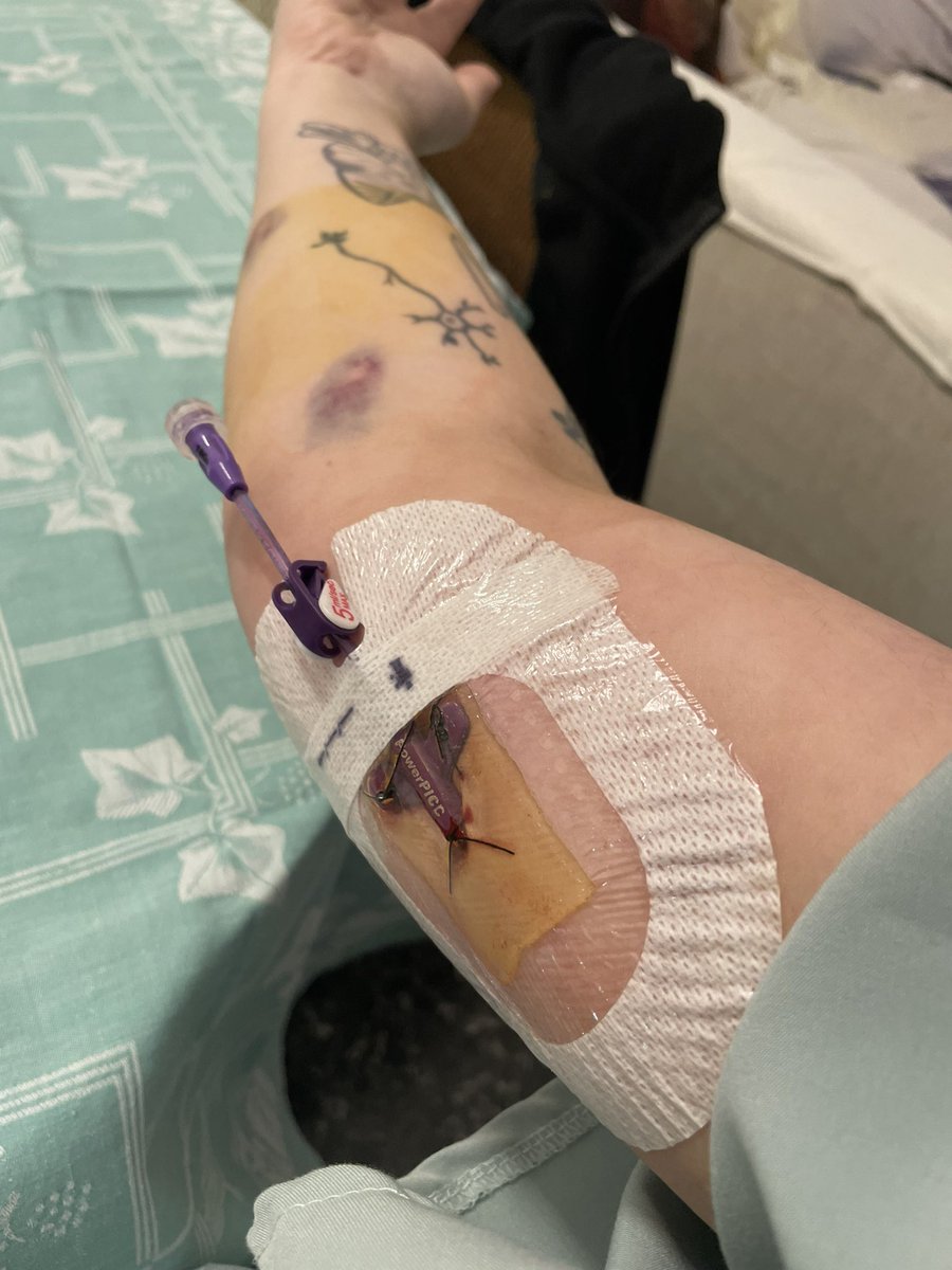🆘🆘🆘κάντε RT παιδιά ανάγκη μεγάλη (αν θέλετε φυσικά, εδώ δεν πιέζουμε όπως έχω ξαναπεί 😛)🆘🆘🆘
Και κάναμε κι άλλο χειρουργείο, μέσα σε ένα μήνα έχουν γίνει 2 και περιμένουμε και 3, ελπίζω αυτό το 3 να είναι το τελευταίο αν και όπως φαίνεται, σιγά μην είναι, πάμε για 4ο