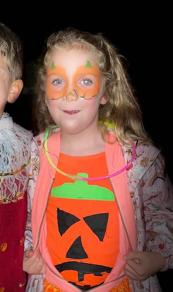 ChectUK's tweet photo. Cameras often use flash during events in the autumn and winter months, which may highlight a white glow in the pupil—a potential sign of retinoblastoma. If you notice this, please visit an optician or GP as soon as possible: https://t.co/5CsppAcMAO https://t.co/y7O8xBDkCE