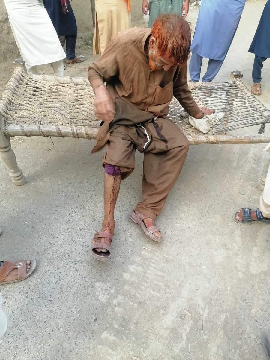 Adnan_Wxr's tweet photo. بکاخیل میں پاکستانی فوج نے ہیلی کاپٹر سے فائرنگ اور مزائیل برسائے ہیں جن میں کئی افراد شہید اور درجنوں افراد زخمی و مالی نقصان، پاکستانی ریاست کی ڈالری جنگ پرزور سے جاری ہے، ریاست پاکستان پشتونوں کے خون پر کامیابی کے ساتھ ڈالر لے رہےہیں۔
#StopStateTerrorism https://t.co/75iorEq45a
