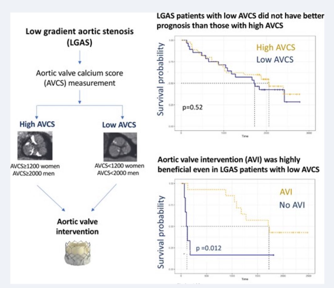 EHJCVI Editor-in-Chief (@ehjcvieic) on Twitter photo Translating findings into clinical practice : what does it mean to have low calcium score #YesCCT in low gradient AS?
Read here under #EHJCVI this interesting manuscript by Dr Juhasz <a href="/PalMaurovich/">Pál Maurovich-Horvat</a> and colleagues ➡️ academic.oup.com/ehjcimaging/ad… <a href="/ESC_Journals/">European Society of Cardiology Journals</a> <a href="/bernhard_gerber/">Bernhard Gerber</a> Translating findings into clinical practice : what does it mean to have low calcium score #YesCCT in low gradient AS?
Read here under #EHJCVI this interesting manuscript by Dr Juhasz <a href="/PalMaurovich/">Pál Maurovich-Horvat</a> and colleagues ➡️ academic.oup.com/ehjcimaging/ad… <a href="/ESC_Journals/">European Society of Cardiology Journals</a> <a href="/bernhard_gerber/">Bernhard Gerber</a>