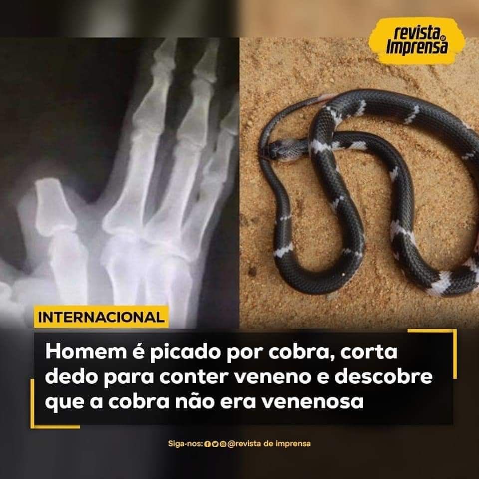 Elvis tweet media