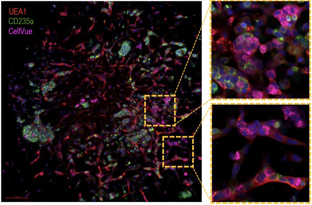 PengJi_lab's tweet photo. Delighted to share our newly published article on the development of iPSC-derived human bone marrow organoid for autonomous hematopoiesis and patient-derived HSPC engraftment. https://t.co/DSHJlLRV9z  Congratulations to our lead author @Kehan_Ren_PhD, soon to be on the job market https://t.co/4rLgHyhlhi