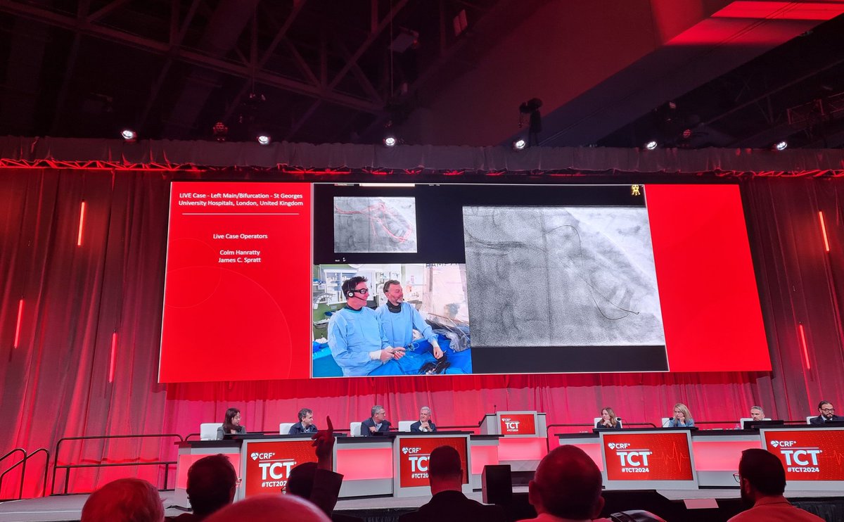Great live cases from St Georges London at TCT by the masters <a href="/jcspratt/">jcspratt</a> <a href="/cghanratty/">@colmhanratty</a>. Impressive pre-procedural planning with CT and CT-FFR and discussion on management of complex ISR and diffuse disease. 
<a href="/crfheart/">Cardiovascular Research Foundation</a>