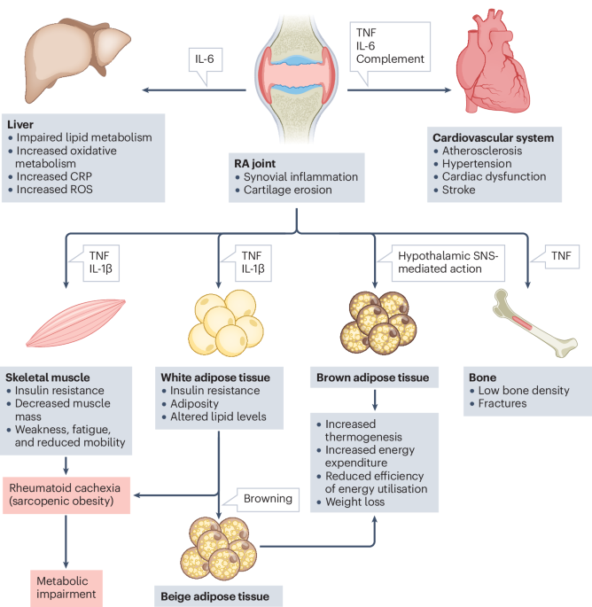 New online! Rheumatic diseases and metabolism: where centre and periphery meet go.nature.com/3YqecFQ