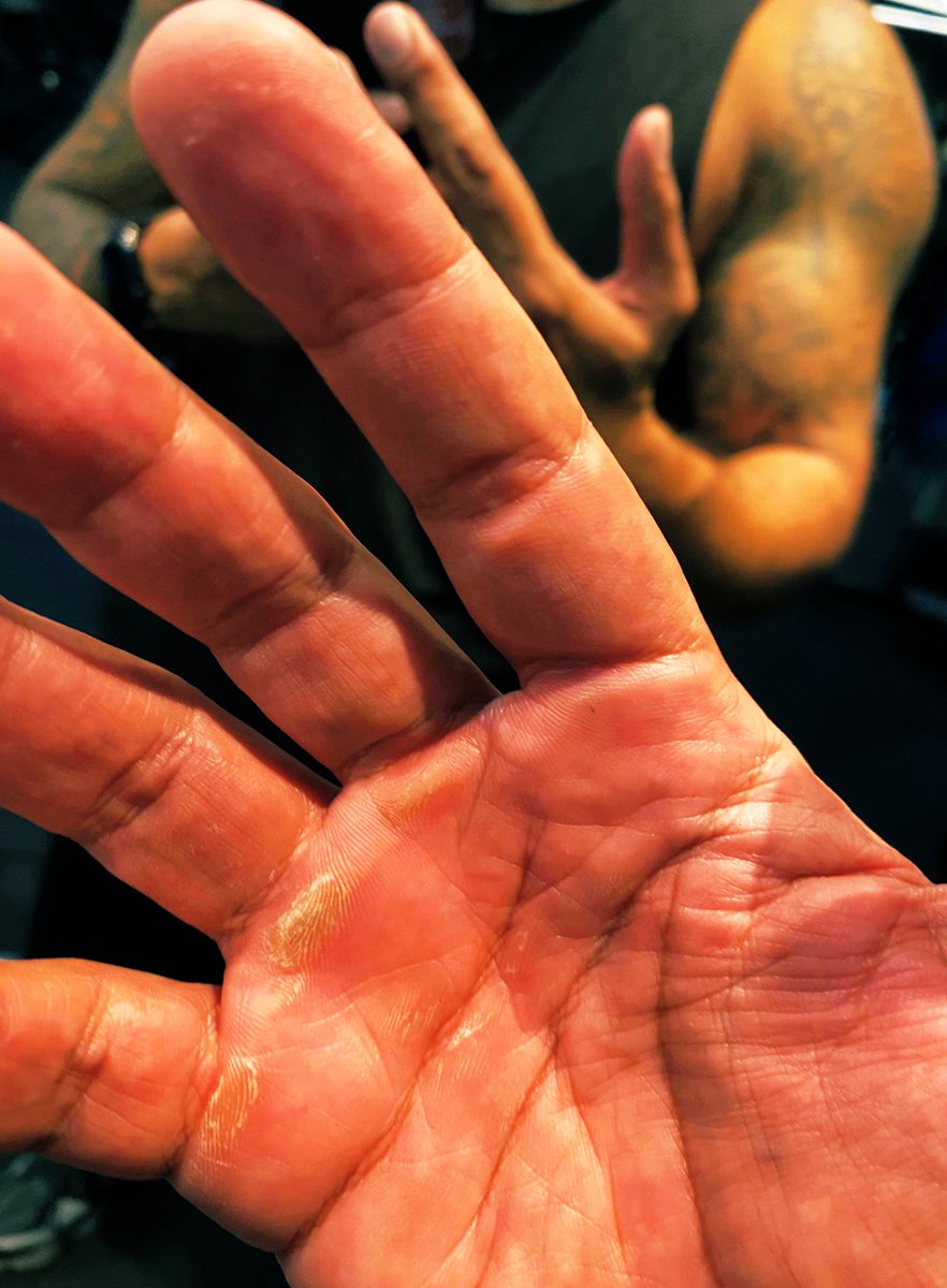 garacucuk's tweet image. Siz benim neler çektiğimi nerden bileceksiniz #backworkout