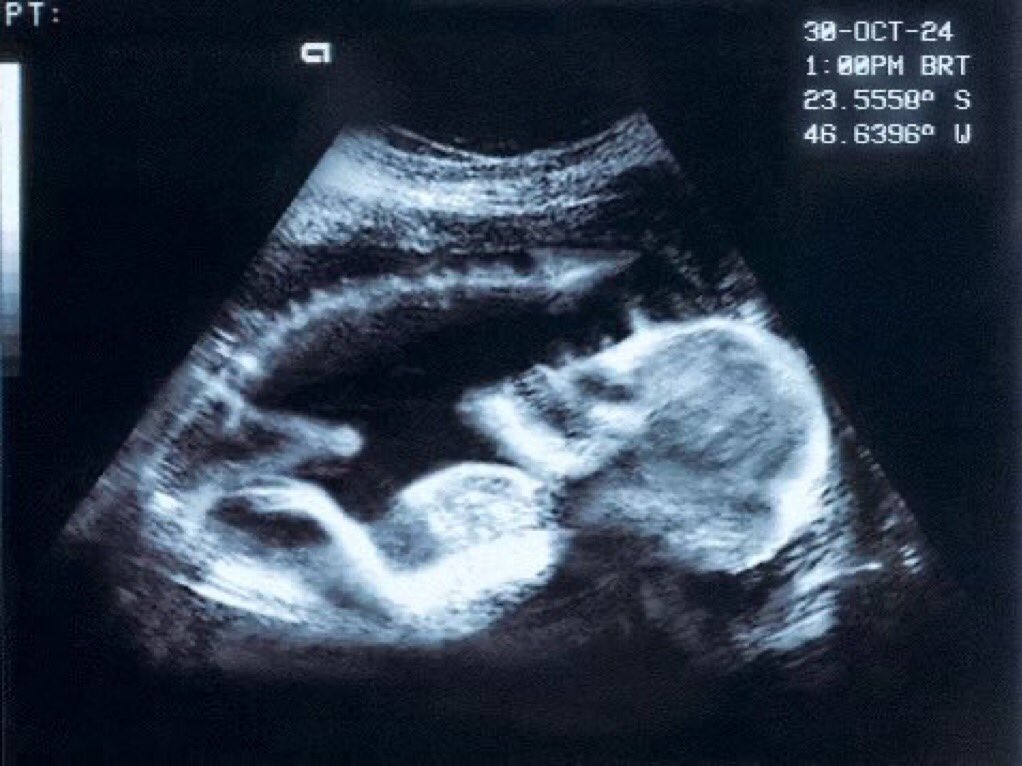 3 mil tweets 

SÃO PAULO TODAY