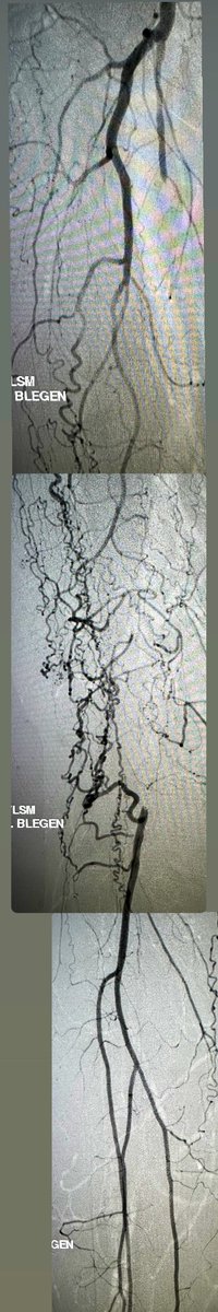 Zach Blegen-DiPietro, MD tweet media