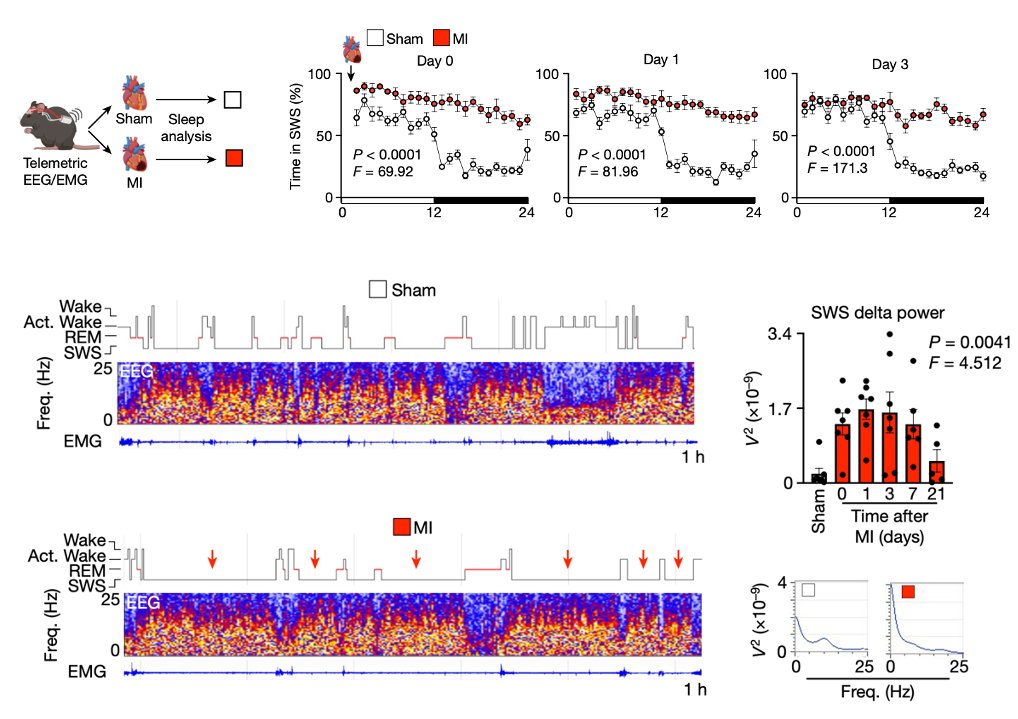 We find that atherosclerosis, heart failure, and myocardial infarction (MI) profoundly augment sleep. MI elicits a significant increase in slow wave sleep pressure, drive, and abundance after infarct. Increased SWS comes at the expense of REM and wake time. How does this happen?
