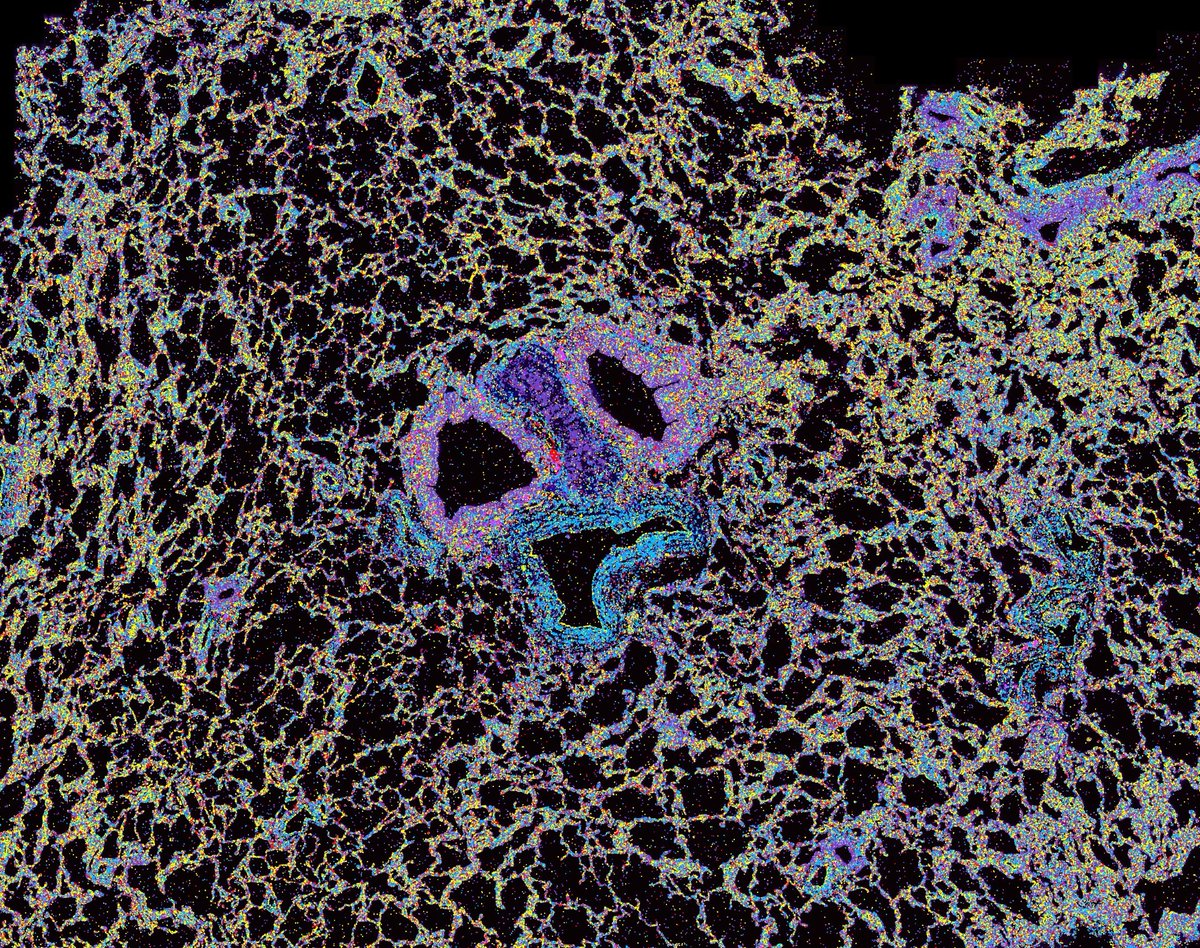 ✨ #SpatialSpotlight Series! ✨

Featuring a stunning image from our #MERSCOPE Platform!

🔬 2 healthy lung airways, 1 blood vessel in the center, and alveoli surrounded by 7M+ detected transcripts color-coded by cell lineage. 

📸 Credit: Arianna Williams, <a href="/TGenResearch/">TGen</a>