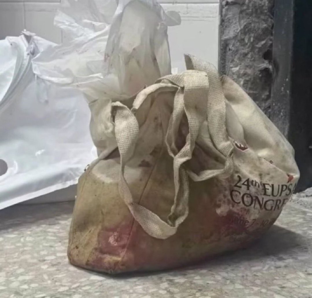 Bu çantanın içinde bir çocuk var..!!