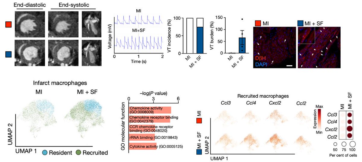 Increased sleep after MI is beneficial. In mice, fragmenting sleep after an MI worsens cardiac inflammation and damage. Sleep and TNFR1+ thalamic neurons limit sympathetic outflow from the brain to the heart, curtailing cardio-inflammation in a macrophage ADRβ2-dependent manner.