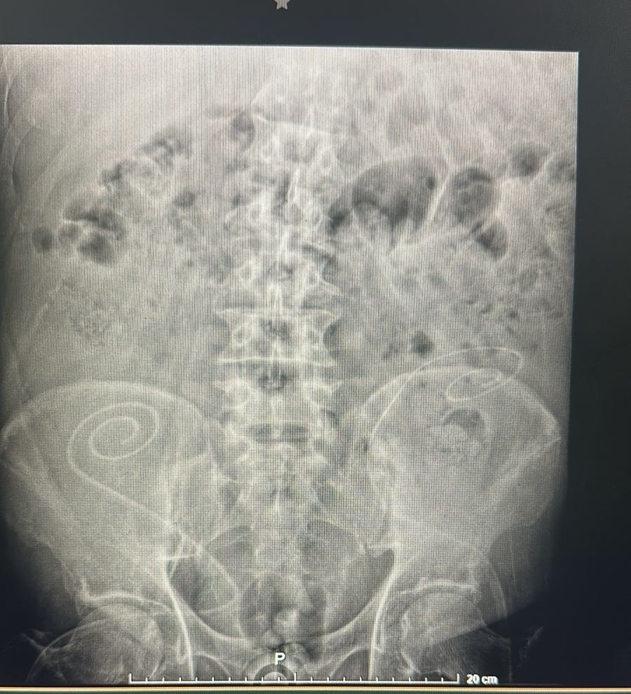auror_neph's tweet photo. @AcidoRinon Parece que hay primates en todos lados 😵‍💫 https://t.co/cz0azUdIL0