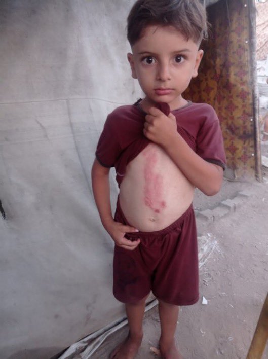 PLEASE DON'T SKIP ME :((

My account has been restricted, 
So, my gfm doesn't appear to everyone! 
Please support my family gfm !!
by sharing and quoting and donating 💔🙏🏻🚨

Please, Leave a comment 🇵🇸 or 🍉
gofund.me/4556904d