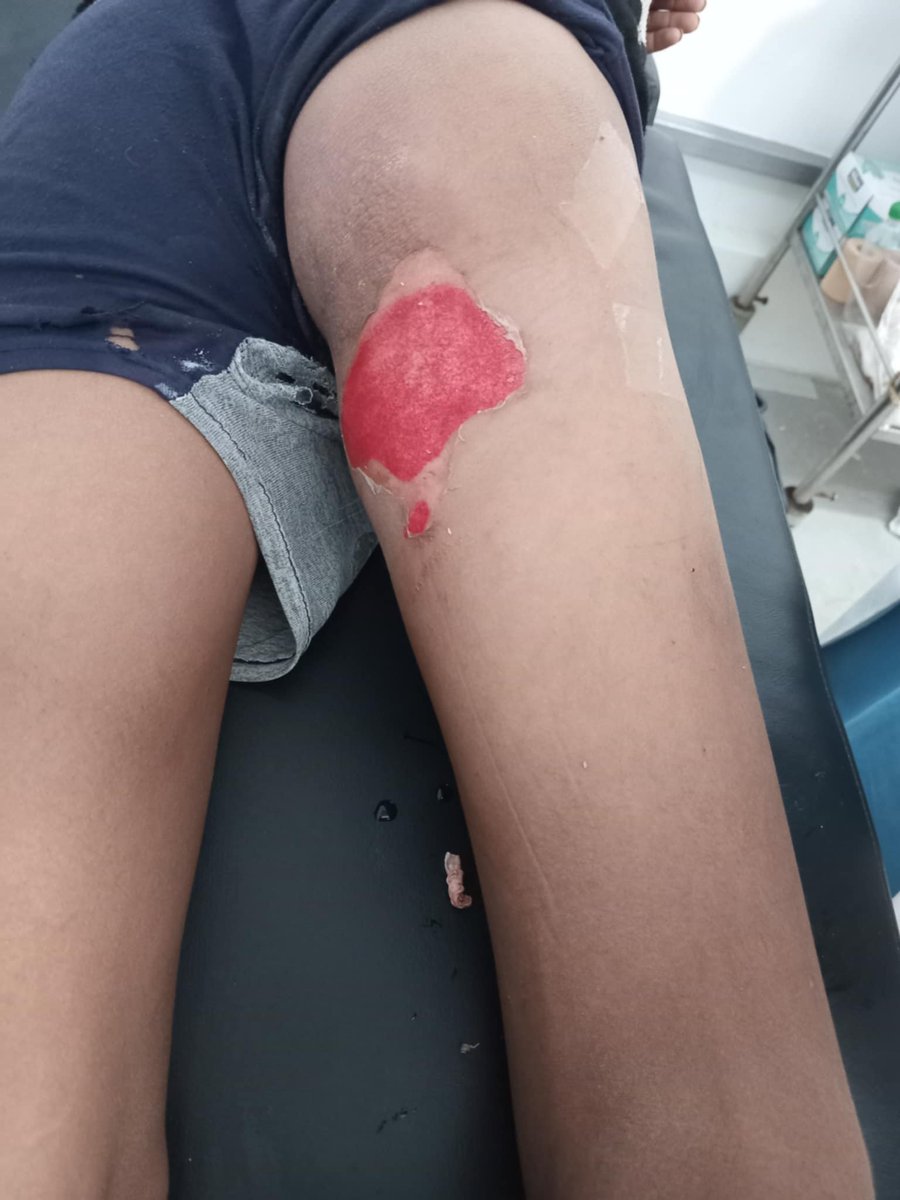 PLEASE DON'T SKIP ME :((

My account has been restricted, 
So, my gfm doesn't appear to everyone! 
Please support my family gfm !!
by sharing and quoting and donating 💔🙏🏻🚨

Please, Leave a comment 🇵🇸 or 🍉

We die of hunger every day
gofund.me/dafc3083