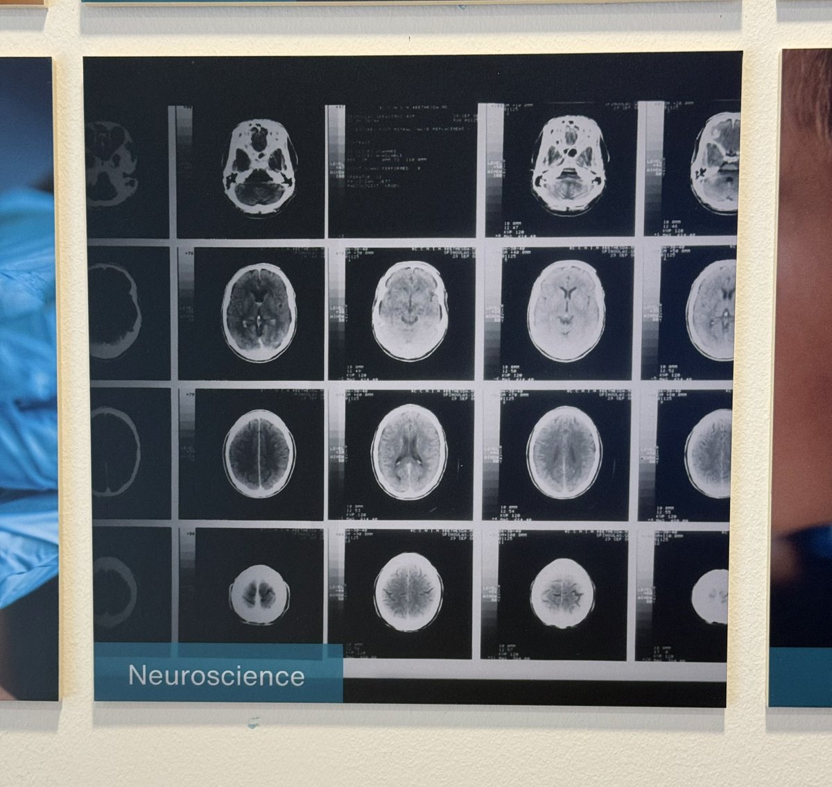 BendyBrain: Dr Jessica Eccles tweet media