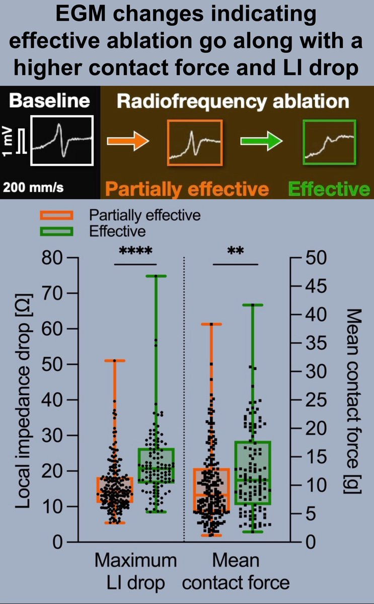 Fares-Alexander Alken (@alkenmd) on Twitter photo 🔥📴 the press #EPeeps: Effective redo atrial arrhythmia RFA can be challenging - check out our in-depth analysis on force/impedance/power interactions <a href="/hrs_journal/">HeartRhythm</a> ❗️#EPDUS
▶️ CF ≥10 g is key for ⬆️LI drops with power 🆙
<a href="/C_Meyer_MD/">Christian Meyer, MD, MA</a> <a href="/AK_Kahle/">Ann-Kathrin Kahle</a> <a href="/th3k4ty/">Dr. Katharina Scherschel</a>
👉authors.elsevier.com/a/1jyWR_ZByiSs… 🔥📴 the press #EPeeps: Effective redo atrial arrhythmia RFA can be challenging - check out our in-depth analysis on force/impedance/power interactions <a href="/hrs_journal/">HeartRhythm</a> ❗️#EPDUS
▶️ CF ≥10 g is key for ⬆️LI drops with power 🆙
<a href="/C_Meyer_MD/">Christian Meyer, MD, MA</a> <a href="/AK_Kahle/">Ann-Kathrin Kahle</a> <a href="/th3k4ty/">Dr. Katharina Scherschel</a>
👉authors.elsevier.com/a/1jyWR_ZByiSs…