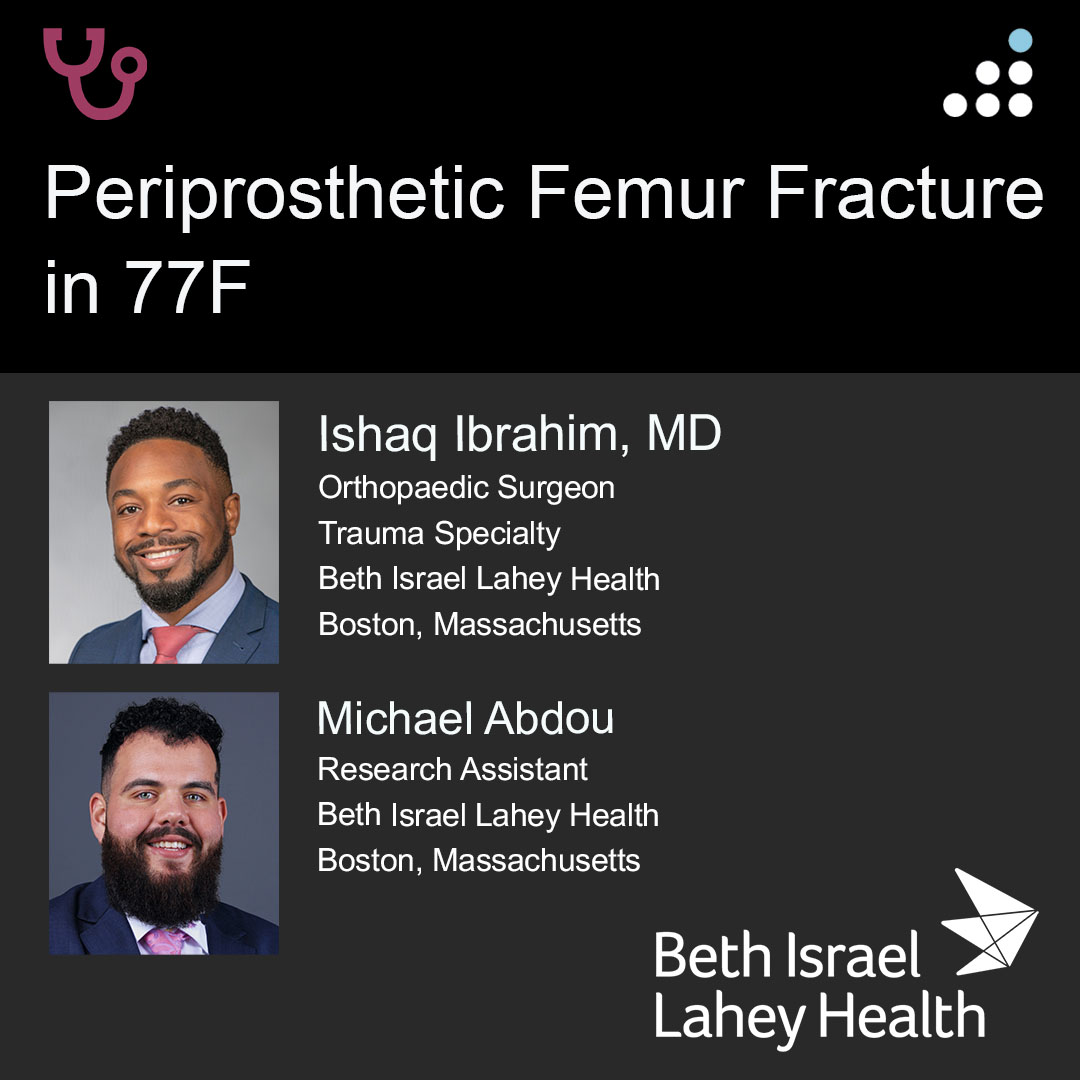 Here is a new case by Dr. Ishaq Ibrahim and Michael Abdou from Beth Israel Lahey Health (<a href="/bethisraellahey/">Beth Israel Lahey Health</a>).

PERIPROSTHETIC FEMUR FRACTURE IN 77F

How would you manage this #orthotwitter?

Vote on this case for CME: orthobullets.tiny.us/yc3tbdu6