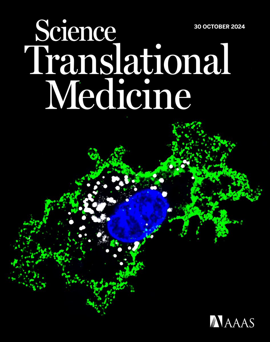Foamy macrophages (aka tumor associated foam cells or TAFs) on the cover of <a href="/ScienceTM/">Science Translational Medicine</a> 
These lipid laden macrophages have distinct pro-tumoral effects &amp; have been described in several tumors such as glioblastoma (here):
science.org/doi/10.1126/sc…
See also recent <a href="/CellCellPress/">Cell</a>