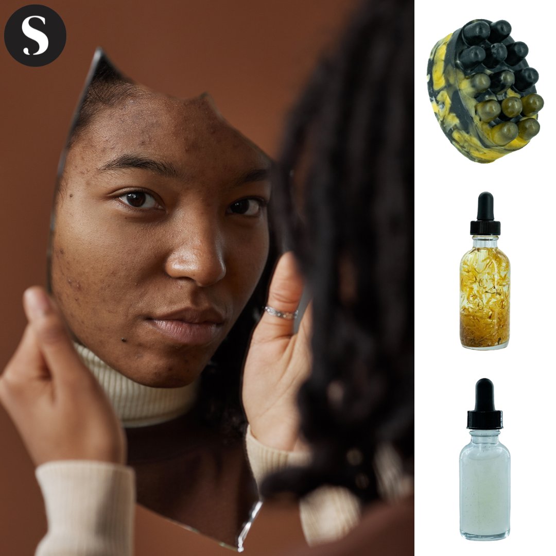 Selphfskincare's tweet photo. If your face is out there, breaking mirrors! 

It's your own fault!

B/c Selphf Skincare has been out here working miracles for over 5 years! We have the remedy!

ft. Vibrant Selphf Face Care Bundle

https://t.co/OlpC154frk

#face #struggle #ugly #beauty #change #acne #treatment https://t.co/mFnvNv7GEy
