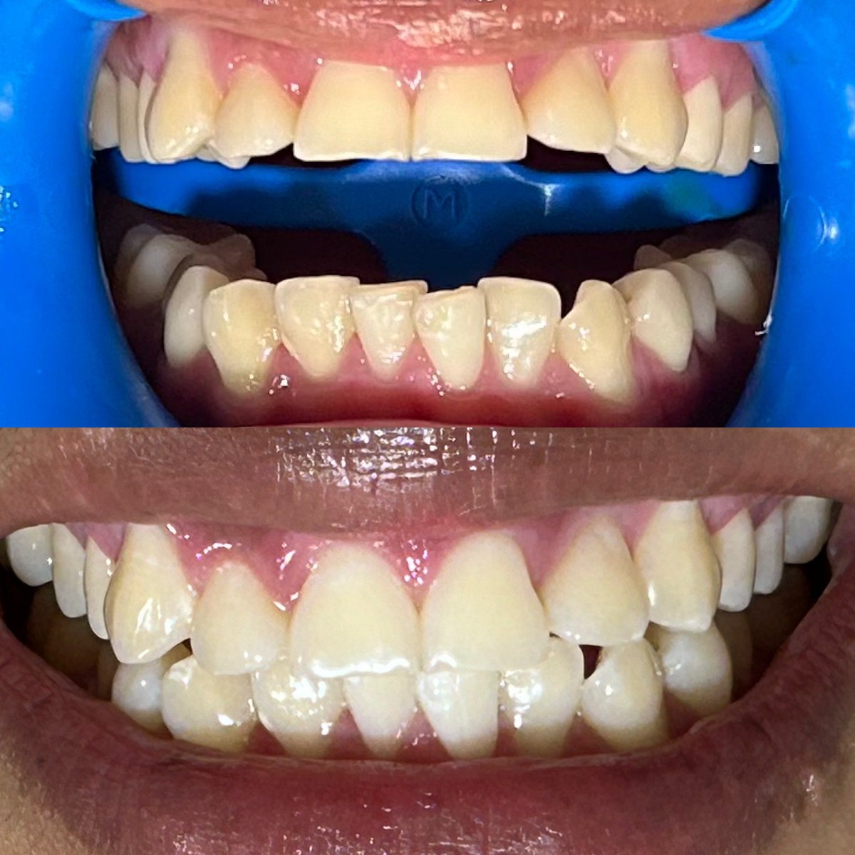 Jose Gabriel (@dentista4you) on Twitter photo 