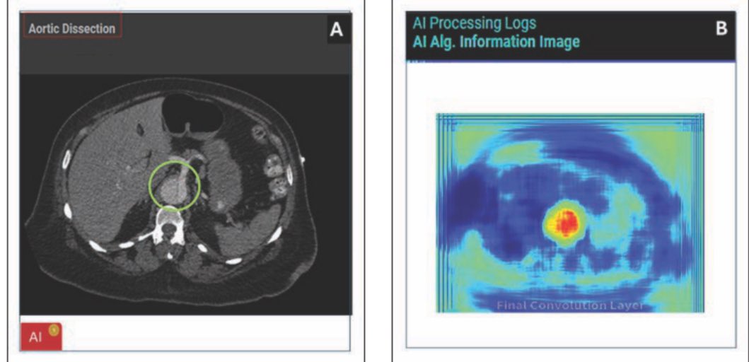 Amit Gupta (@amitgupta_83) on Twitter photo Exciting news!
Our second paper on AI in radiology in last two days, has just been published in the American Journal of Radiology.
The paper outlines key strategies for effective AI integration.
ajronline.org/doi/abs/10.221ā¦
<a href="/UHRadiology/">UH Radiology Cleveland</a>
<a href="/AJR_Radiology/">AJR</a>
<a href="/UHChestCardiac/">UH Cardiothoracic Imaging</a> Exciting news!
Our second paper on AI in radiology in last two days, has just been published in the American Journal of Radiology.
The paper outlines key strategies for effective AI integration.
ajronline.org/doi/abs/10.221ā¦
<a href="/UHRadiology/">UH Radiology Cleveland</a>
<a href="/AJR_Radiology/">AJR</a>
<a href="/UHChestCardiac/">UH Cardiothoracic Imaging</a>