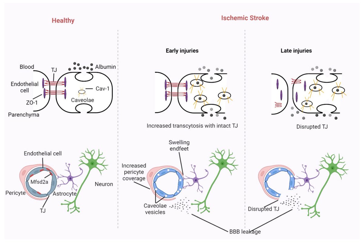 Biomed_MDPI's tweet photo. #recommendedpaper #stroke #comprehensivereview #biomedicines
Today's recommended article is as follows:😎
Title: Integrative Approaches in Acute Ischemic Stroke: From Symptom Recognition to Future Innovations
For details, please check:↩️
https://t.co/T5HefkwBe3
@MDPIOpenAccess https://t.co/Ru4kerITci