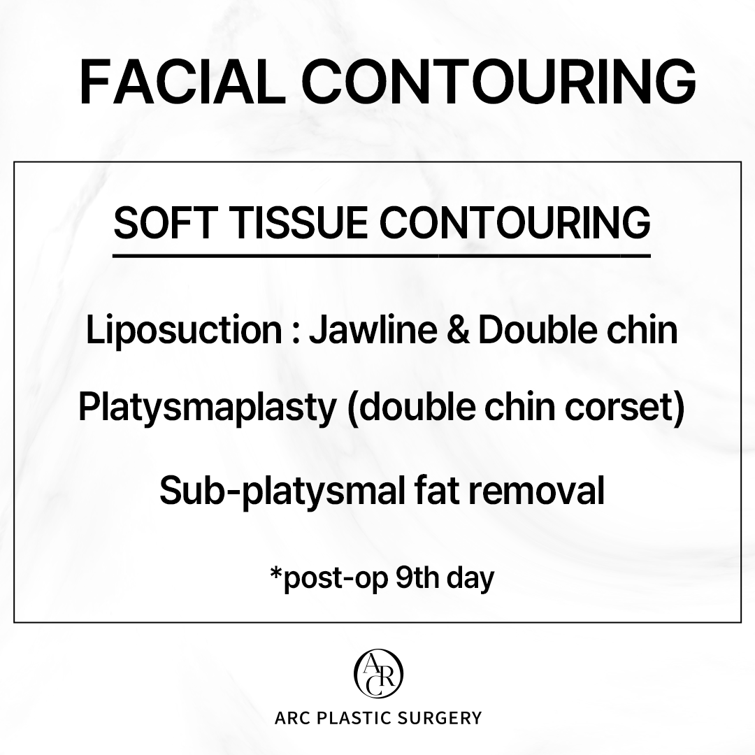 dr_kwonsoonbeom's tweet photo. [FINE ARC]
Soft Tissue Contouring
✔Performed by Dr. Kwon Soon Beom
***
Facial liposuction: Jawline &amp; Double chin
Platysmaplasty (double chin corset)
Sub-platysmal fat removal
***
#platysmaplasty #arcplasticsurgery #drkwonsoonbeom #facialcontouring #아크성형외과 #アーク整形外科 https://t.co/kereezPFQD