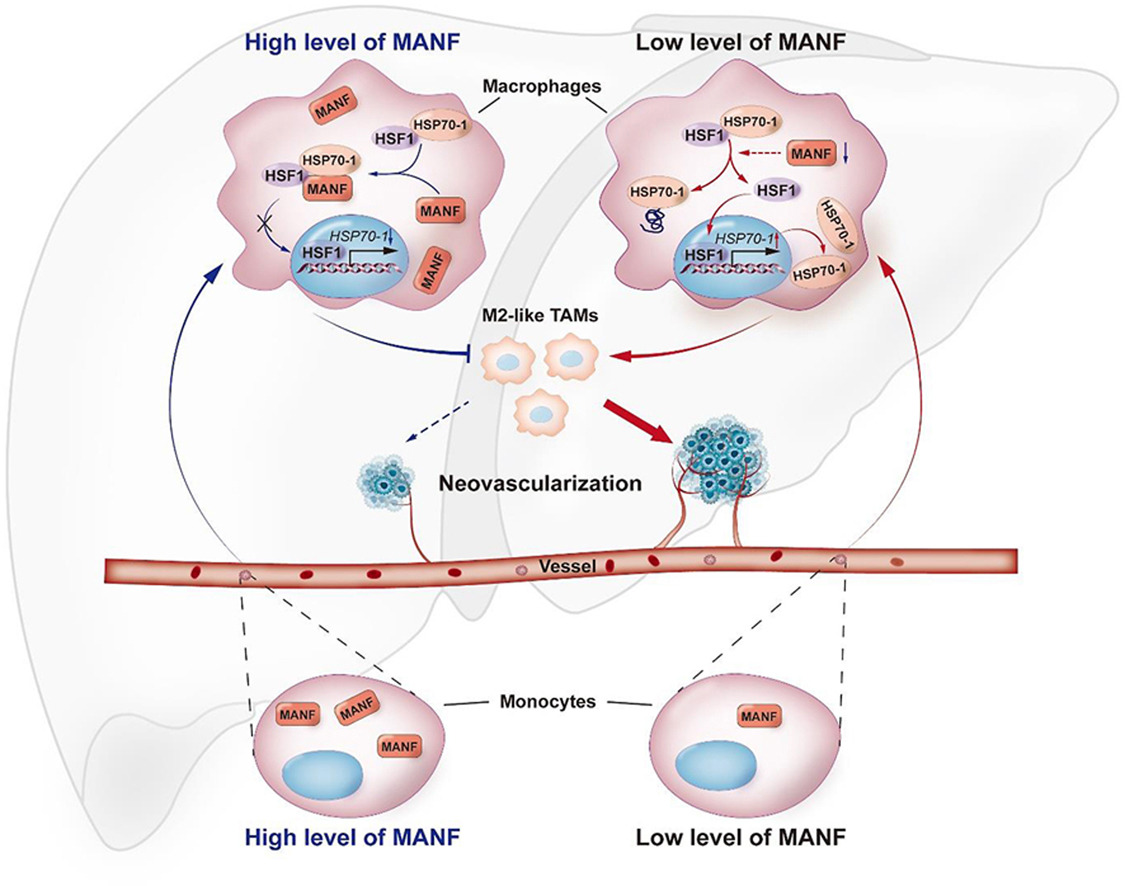 ActaPharmSinB's tweet photo. Article✍️Reprogramming tumor-associated #macrophages and inhibiting #tumor #neovascularization by targeting #MANF–#HSF1–#HSP70-1 pathway: An effective treatment for #hepatocellular #carcinoma. From Dr. Hu @AnhuiMedicalUniversity; @ELSpharma.
https://t.co/N9LmFmVkiK. https://t.co/1AF17wuxL9