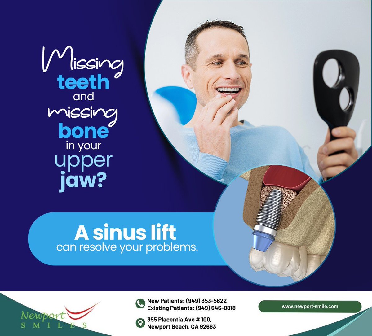 Newport_smile's tweet image. A sinus lift facilitates implant placement by restoring lost bone in the upper jaw. Book a consultation with our team at newport-smile.com to learn more about #sinuslift surgery. 
#dentalimplants #sinusaugmentation #newportsmiles #newport #CA