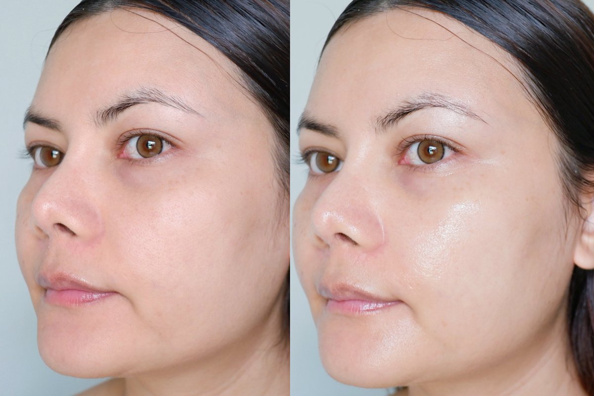 ใครยังลังเลไม่รู้จะใช้ มอยเจอร์ Skintific สูตรไหนดี โพสต์นี้สรุปมาให้แล้ววว 
🩵 5X Ceramide Moisture Gel ช่วยเสริมเกราะปกป้องผิวแข็งแรง เนื้อเจลบางเบา ซึมไว สบายผิว ผิวนุ่มชุ่มชื้น ผิวอิ่มฟู ปลอบประโลมผิว รอยแดง สิวอักเสบได้ดี เหมาะกับผิวบอบบาง แพ้ง่าย และผิวแห้งขาดน้ำ

🩷 MSH Niacinamide Moisture Gel ช่วยปรับผิวให้ชุ่มชื้นผิวดูโกลว์กระจ่างใส เนื้อเจลบางเบา ซึมไว ไม่เหนอะผิว ผิวชุ่มชื้นขึ้นแต่ไม่มัน รอยแดง รอยสิวจางไวขึ้น เหมาะกับคนมีจุดด่างดำ รอยแดงจากสิว ผิวหน้าหมองคล้ำ สีผิวไม่สม่ำเสมอ 
#ใช้ดีบอกต่อ #Skintific
