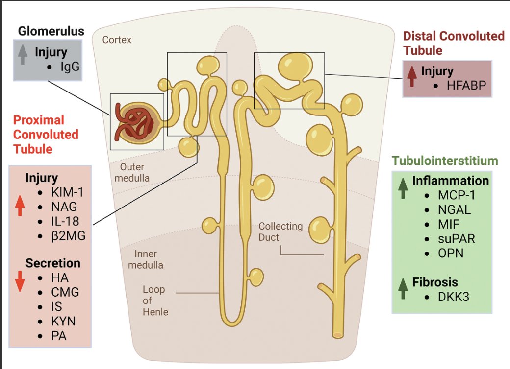 #Biomarkers of Kidney Disease Progression in #ADPKD

doi.org/10.1016/j.ekir…

#KIRReview