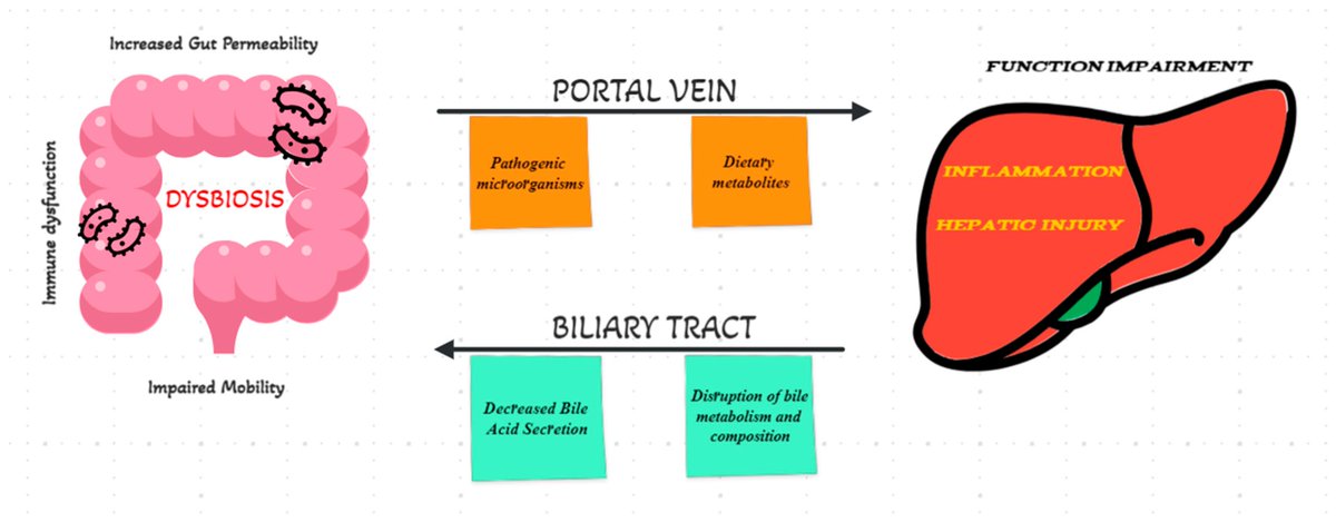 Biomed_MDPI's tweet photo. #recommendedpaper 
#comprehensivereview 
#biomedicines
#liverdisease
Today's recommended article is as follows:🍊
Title: Fecal Microbiota Transplantation in Liver Cirrhosis
For details, please check:↩️
https://t.co/y1wMaIirXm https://t.co/acDsyO3gSO
