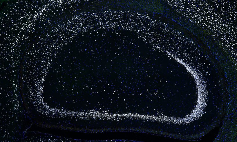 CBD_VIB's tweet image. 🤔 Can we protect nerve cells from dying in #Alzheimers? New research published in Science Translational Medicine has identified specific inhibitors that can prevent the loss of nerve cells in mouse models of the disease! @VIBLifeSciences @KU_Leuven 👉 cbd.sites.vib.be/en/news#/news/…