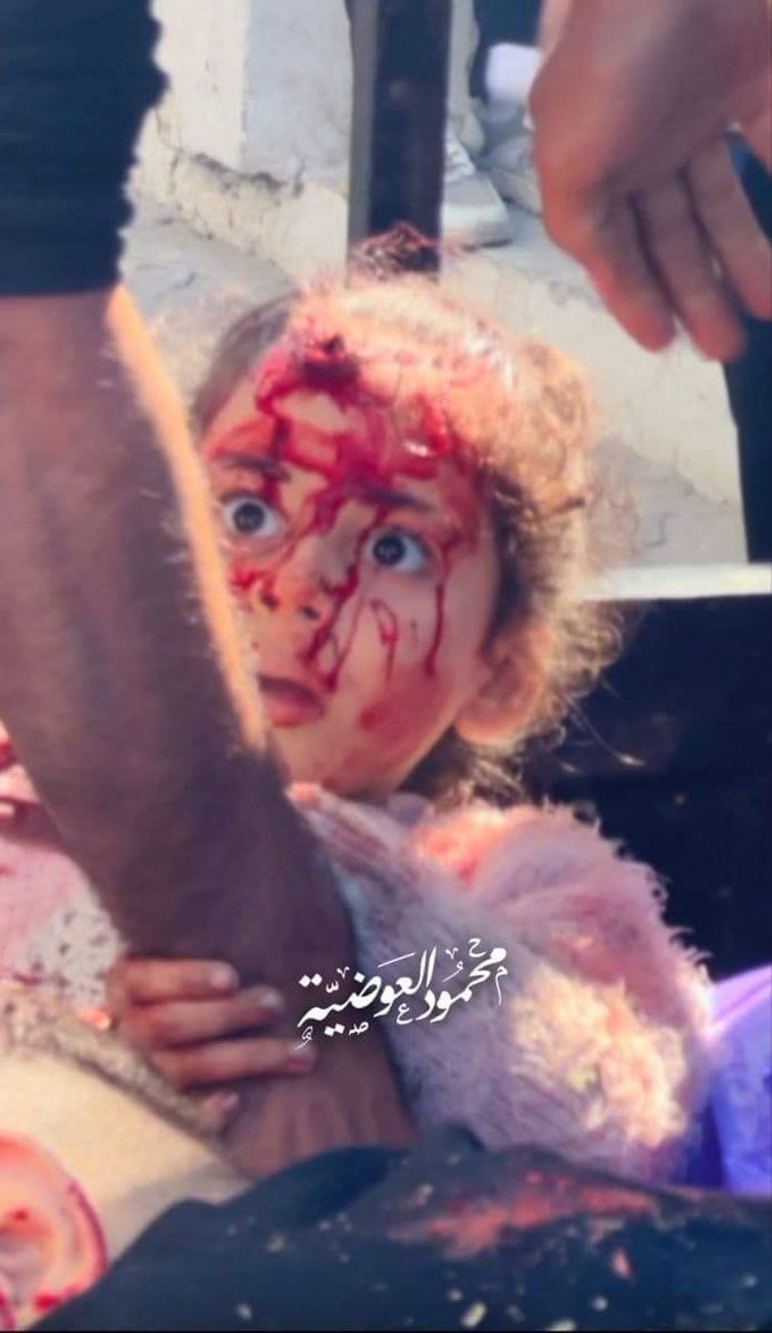 المشهد أمامكم الان
الصورة تتحدث عن نفسها 
#شمال_غزة_يباد
