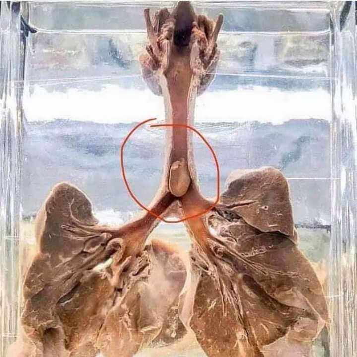 Estamos tostando unos cacahuetes para merendar ahora mismo y me he acordado de esta imagen. 𝐋𝐨𝐬 𝐩𝐞𝐝𝐢𝐚𝐭𝐫𝐚𝐬 𝐬𝐢𝐞𝐦𝐩𝐫𝐞 𝐫𝐞𝐜𝐨𝐦𝐢𝐞𝐧𝐝𝐚𝐧 𝐪𝐮𝐞 𝐥𝐨𝐬 𝐦𝐞𝐧𝐨𝐫𝐞𝐬 𝐝𝐞 𝟓 𝐚ñ𝐨𝐬 𝐧𝐨 𝐜𝐨𝐦𝐚𝐧 𝐜𝐚𝐜𝐚𝐡𝐮𝐞𝐭𝐞𝐬 𝐮 𝐨𝐭𝐫𝐨𝐬 𝐟𝐫𝐮𝐭𝐨𝐬 𝐬𝐞𝐜𝐨𝐬