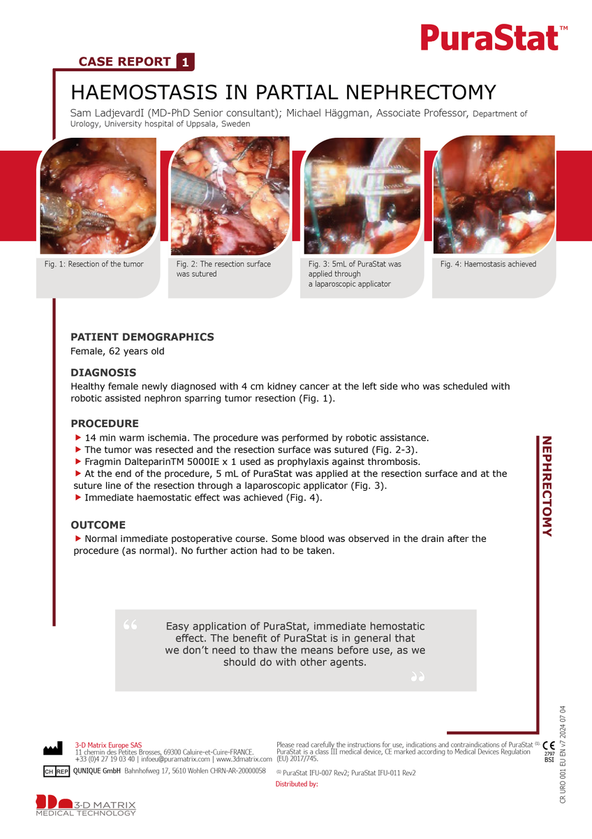 3dm_emea's tweet photo. Download the full case report to see #PuraStat in action during #PartialNephrectomy and learn how it can enhance your urology procedures: https://t.co/lAx4MyHSP2
#urology #purastat #medicaldevices #peptidetechnology #bleedingmanagement #patientoutcomes #urologyprocedure https://t.co/HaVO2weElI