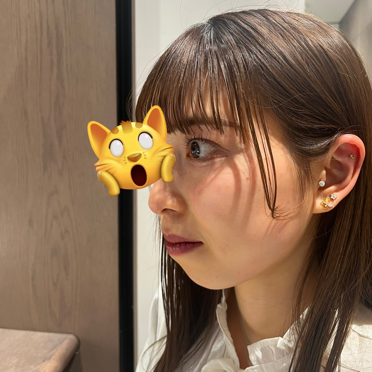 me_o089's tweet image. 両顎手術からもうすぐ2ヶ月🌸
同一人物！？って自分でも疑うくらいアップデートできてる😭🤍
本当にここまでナチュラルに仕上げてくれた👨🏻‍⚕️たちに感謝でしかない