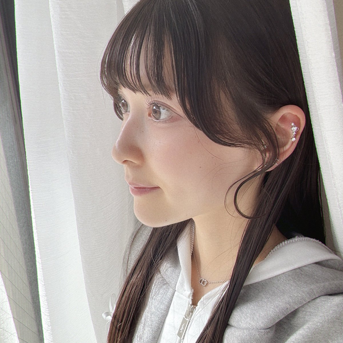 me_o089's tweet image. 両顎手術からもうすぐ2ヶ月🌸
同一人物！？って自分でも疑うくらいアップデートできてる😭🤍
本当にここまでナチュラルに仕上げてくれた👨🏻‍⚕️たちに感謝でしかない