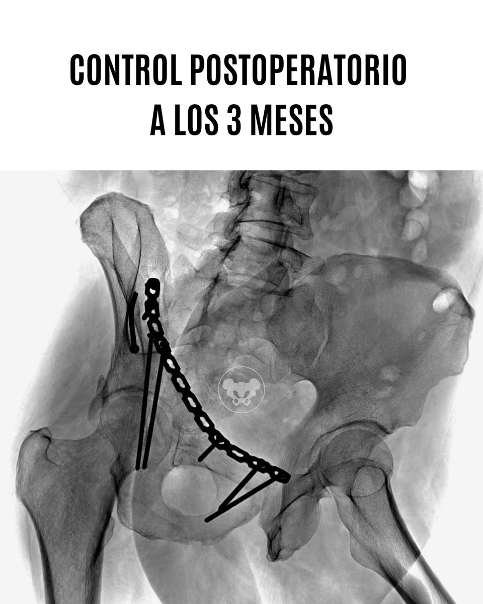 Trauma Pelvis Venezuela tweet media