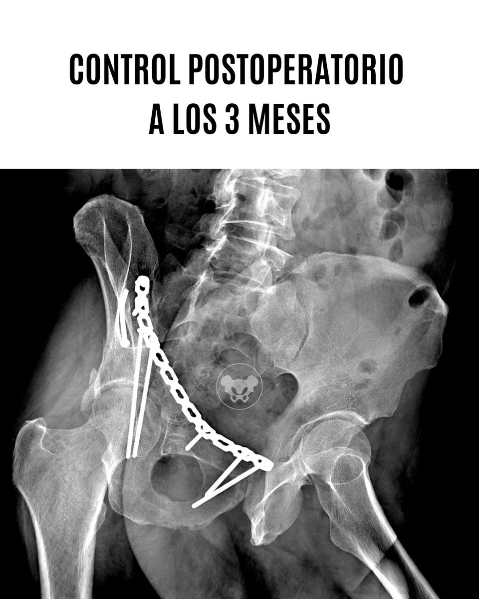 Trauma Pelvis Venezuela tweet media