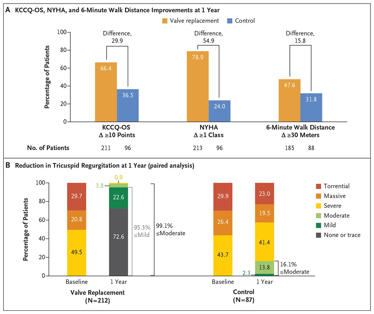 NEJM (@nejm) on Twitter photo Original Article: Transcatheter Valve Replacement in Severe Tricuspid Regurgitation (TRISCEND II) nej.md/4dTODm5
Editorial: Early-Stage Results with Transcatheter Tricuspid-Valve Replacement nej.md/4e29F2f
#TCT2024 | <a href="/crfheart/">Cardiovascular Research Foundation</a> Original Article: Transcatheter Valve Replacement in Severe Tricuspid Regurgitation (TRISCEND II) nej.md/4dTODm5
Editorial: Early-Stage Results with Transcatheter Tricuspid-Valve Replacement nej.md/4e29F2f
#TCT2024 | <a href="/crfheart/">Cardiovascular Research Foundation</a>