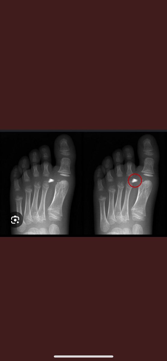 MsKayKayX's tweet photo. Now I know the slow ones have difficulty reading.. so how about analysing the photos instead… 😏🤷🏽♀️
How does any of what she has said make sense…
#GlassFragments #FreeTory #ToryLanez #JusticeForTory #FactsMatter https://t.co/1LdeJvbw9R