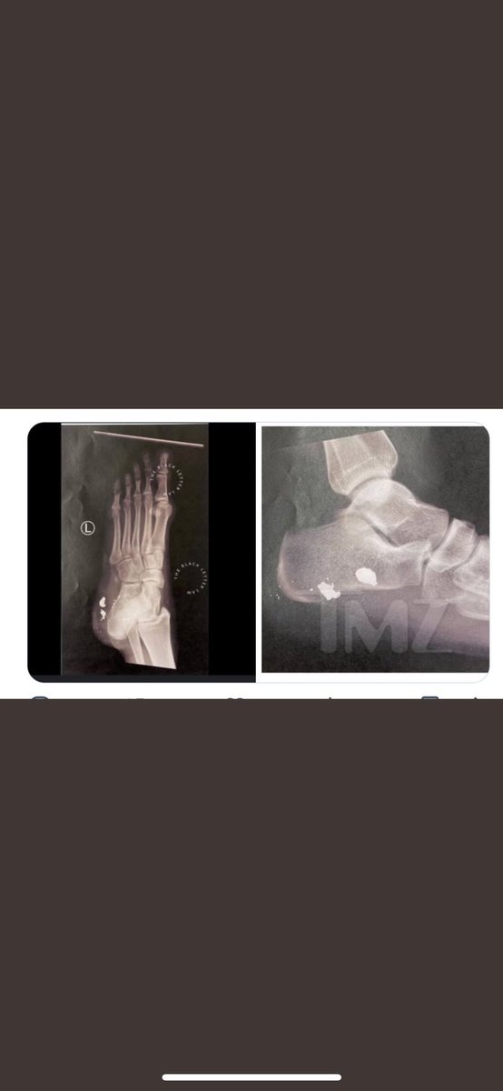 MsKayKayX's tweet photo. Now I know the slow ones have difficulty reading.. so how about analysing the photos instead… 😏🤷🏽♀️
How does any of what she has said make sense…
#GlassFragments #FreeTory #ToryLanez #JusticeForTory #FactsMatter https://t.co/1LdeJvbw9R