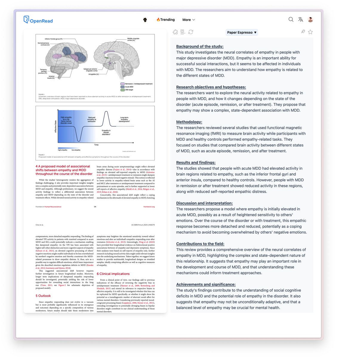 BensenHsu (@bensenhsu) on Twitter photo <a href="/NTFabiano/">Nicholas Fabiano, MD</a> This study investigates the neural correlates of empathy in people with major depressive disorder (MDD). Empathy is an important ability for successful social interactions, but it seems to be affected in individuals with MDD. The researchers aim to understand how empathy is <a href="/NTFabiano/">Nicholas Fabiano, MD</a> This study investigates the neural correlates of empathy in people with major depressive disorder (MDD). Empathy is an important ability for successful social interactions, but it seems to be affected in individuals with MDD. The researchers aim to understand how empathy is