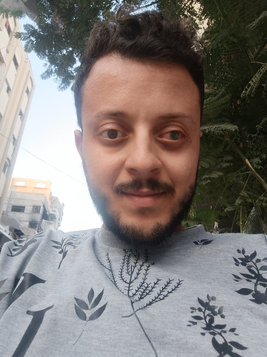 ahmedshameya995's tweet photo. My eye is hurting me alot, but still smiling. 

https://t.co/L2sXrXgHsV https://t.co/HtcVbha9iL