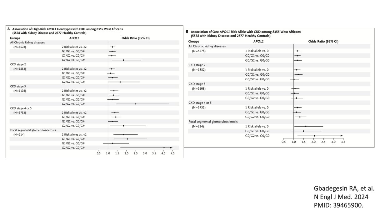 Duke Kidney (@dukekidney) on Twitter photo New from <a href="/GbadegesinLab/">Gbadegesin Lab</a> and colleagues presented at <a href="/ASNKidney/">American Society of Nephrology</a> #KidneyWeek and simultaneously published in <a href="/NEJM/">NEJM</a>
APOL1 Bi- and Monoallelic Variants and Chronic Kidney Disease in West Africans
nejm.org/doi/full/10.10… New from <a href="/GbadegesinLab/">Gbadegesin Lab</a> and colleagues presented at <a href="/ASNKidney/">American Society of Nephrology</a> #KidneyWeek and simultaneously published in <a href="/NEJM/">NEJM</a>
APOL1 Bi- and Monoallelic Variants and Chronic Kidney Disease in West Africans
nejm.org/doi/full/10.10…